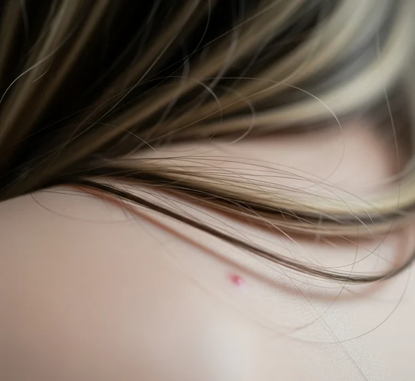 Hair strands touching skin with subtle breakout indicators.